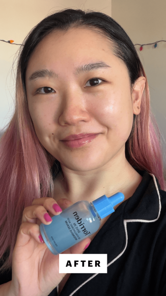 Sarah Han after applying the Torriden 5D Hyaluronic Acid Serum