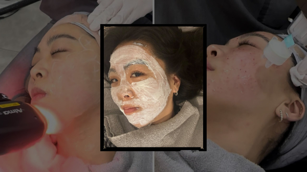 An Insider’s Guide to the Best Beauty Treatments in Seoul